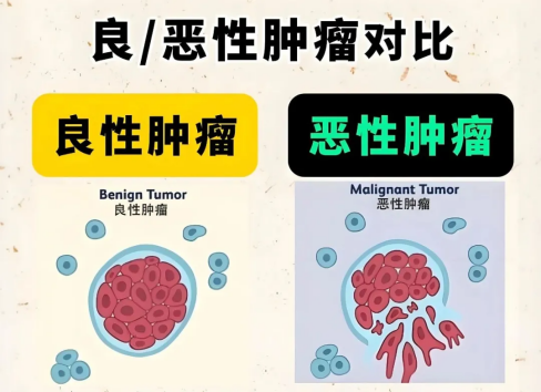 济南中医肝病医院