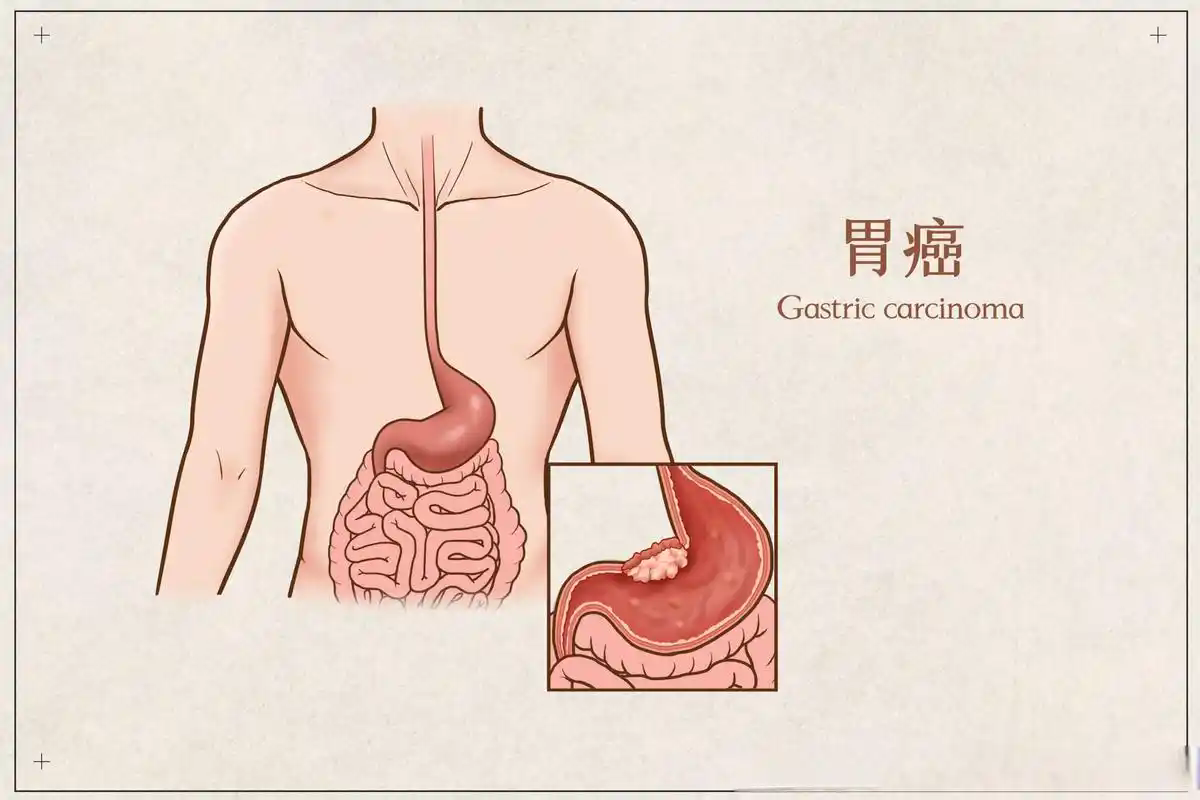 31c05f18929887c120e31c5bf820b765_178583579297a827 31c05f18929887c120e31c5bf820b765_178583579297a827